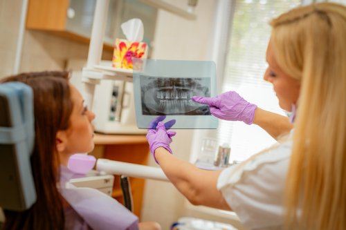 Dentist showing patient dental X-ray during dental exam to improve dental care treatment.