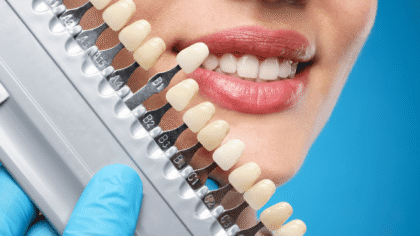 Chelsea Family Dentist MA: Adult Tooth Repairs
